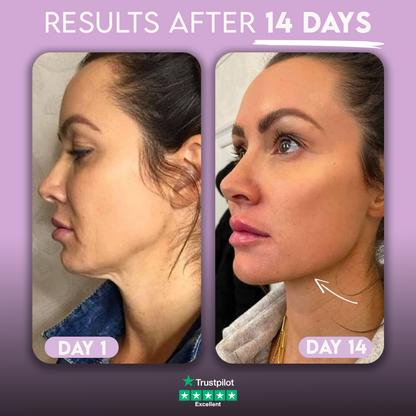 JawLift ™ Collagen Chin Strap Kit